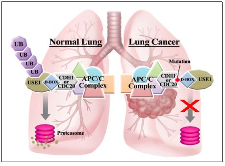 폐암 유발 단백질 발견...조기 진단 가능해진다