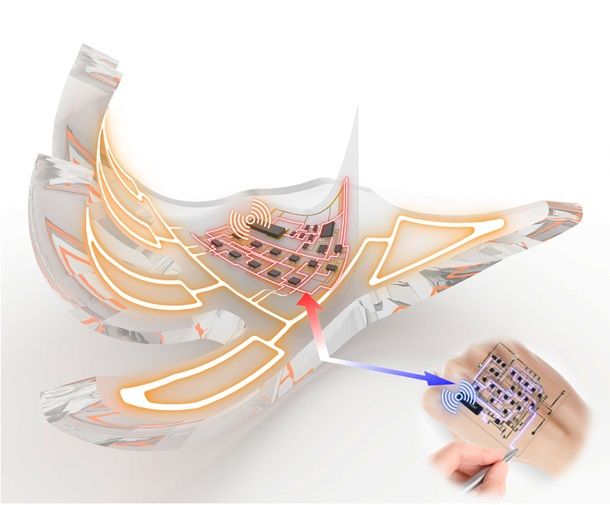 피부처럼 늘어나는 ‘전자피부’ 로봇 개발