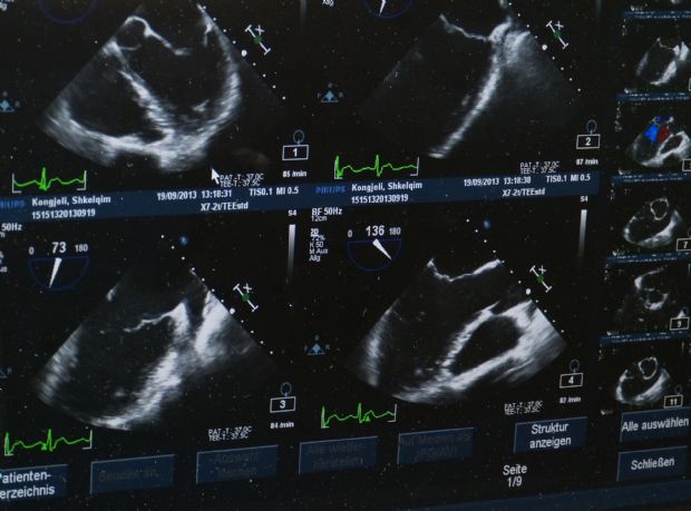 초음파와 MRI 또는 CT 영상을 결합해 환자 몸속 부위를 명확하게 보여주는 AR 영상 기술은 다양한 수술과 수술 훈련에 쓰일 수 있을 것으로 기대된다.(사진=픽사베이)