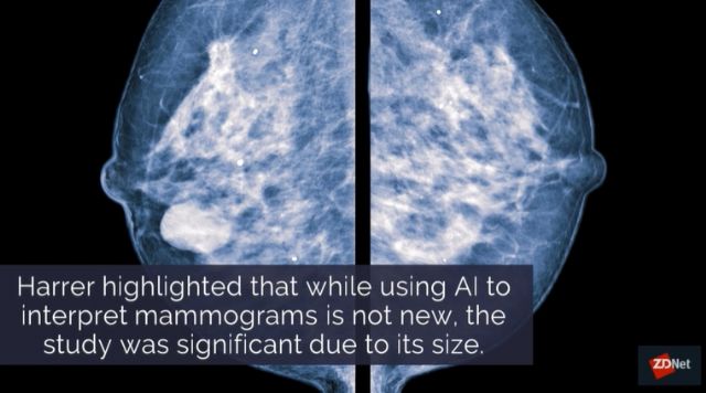 IBM, 최대 규모 유방암 사진 활용한 'AI 진단 모델' 개발