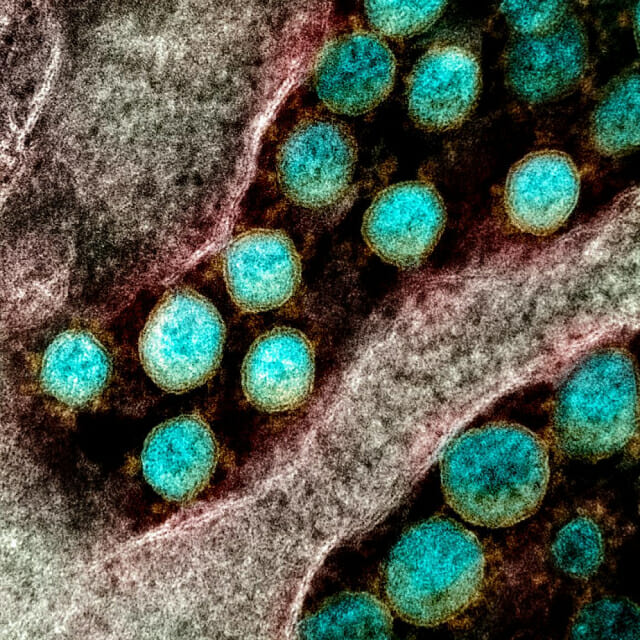 확진환자에게서 분리한 코로나19 바이러스를 전자현미경으로 확대한 모습. (사진=미국국립알레르기·감염병연구소)
