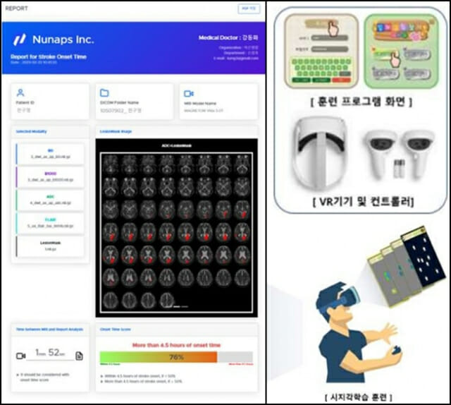 38·39호 혁신의료기기는 뉴냅스 ‘뇌영상검출·진단보조SW’·’인지치료SW’