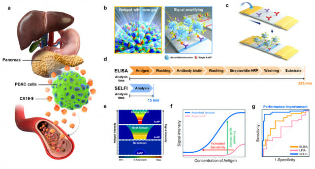 건국대 연구팀, 췌장암 ‘15분 신속 진단’ 신기술 개발 쾌거