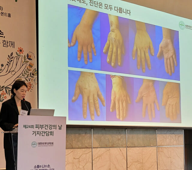 한태영 교수는 손 피부질환 임상 양상 비슷해도 원인과 치료가 달라져 전문의의 정확한 감별진단이 중요하다고 강조했다